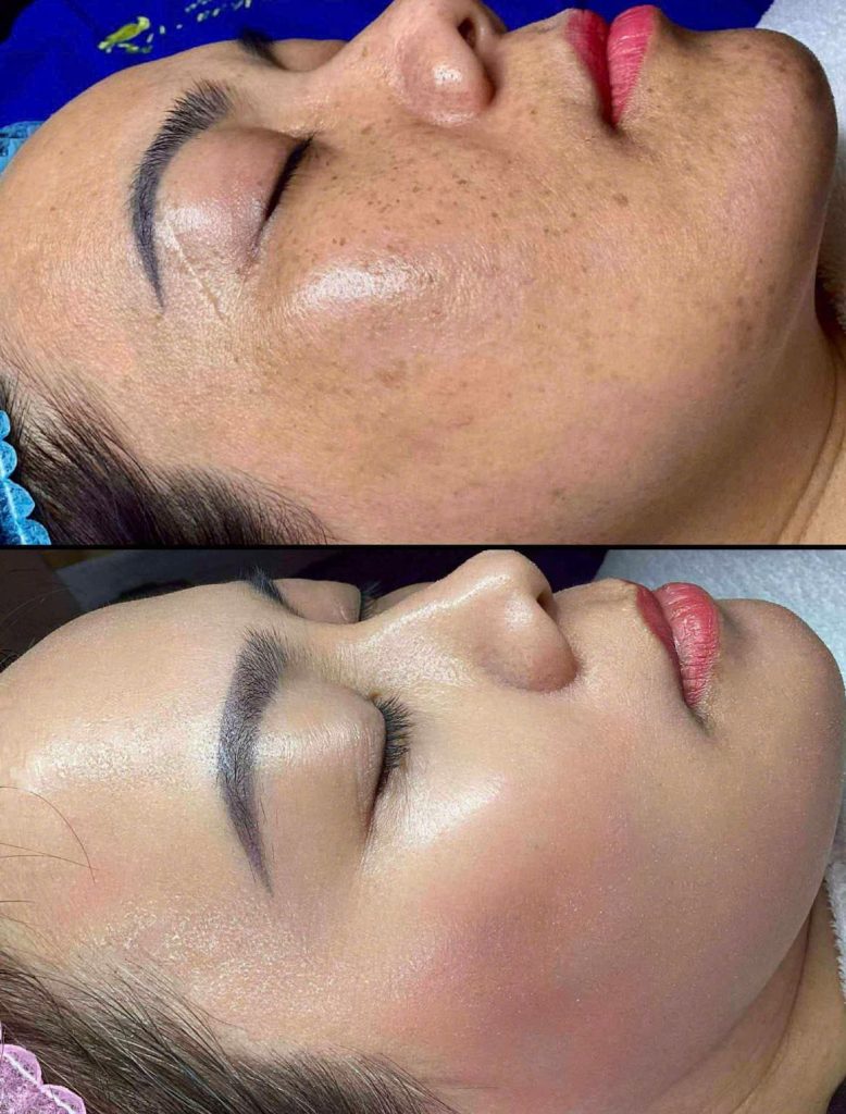 Mỗi liệu trình tại Ivy Beauty & Spa là một hành trình chăm sóc trọn vẹn cho làn da và tinh thần